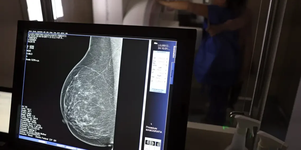 Brasil registrou mais de 108 mil casos de câncer de mama em mulheres com menos de 50 anos entre 2018 e 2023. CBR pede ampliação da faixa etária para mamografia no SUS. Mortalidade cresceu 38% no período.
