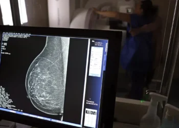 Brasil registrou mais de 108 mil casos de câncer de mama em mulheres com menos de 50 anos entre 2018 e 2023. CBR pede ampliação da faixa etária para mamografia no SUS. Mortalidade cresceu 38% no período.
