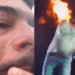 Léo, da dupla sertaneja com Raphael, mostra cicatrizes no rosto após ser atingido por chamas durante show em Pontal (SP). Cantor tranquiliza fãs: “Tá de boa”.