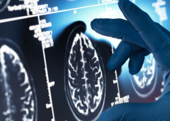 Nova técnica desenvolvida pela Oxford Brain Diagnostics detecta sinais do Alzheimer muito antes dos sintomas surgirem. Inovação é reconhecida como revolucionária por agência dos EUA.