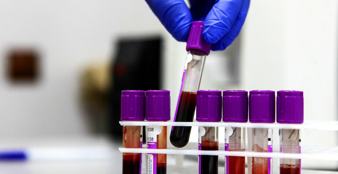 Rússia dá início aos testes clínicos da EnteroMix, vacina experimental contra o câncer que usa vírus para destruir células tumorais. Estudo envolve 48 voluntários com tumores resistentes a tratamentos convencionais.