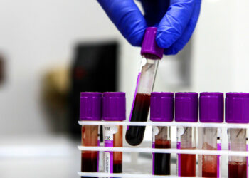 Rússia dá início aos testes clínicos da EnteroMix, vacina experimental contra o câncer que usa vírus para destruir células tumorais. Estudo envolve 48 voluntários com tumores resistentes a tratamentos convencionais.