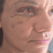 Juliana Garcia dos Santos Soares mostra recuperação após cirurgia de reconstrução facial após ataque violento em Natal. Ex-jogador Igor Cabral é réu por tentativa de feminicídio e segue preso.