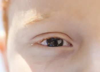 Nova cartilha do CBO orienta sobre saúde ocular infantil, uso de telas, prevenção de miopia e sinais de alerta em bebês e crianças.