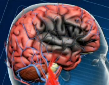 A campanha Agosto Azul e Vermelho conscientiza sobre saúde vascular e prevenção de doenças como infarto, AVC e trombose. Saiba como Vitória promove ações para o bem-estar da população.