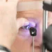 Algoritmo de inteligência artificial identifica glaucoma em exames de retina com alta sensibilidade. Especialistas apontam potencial da tecnologia para diagnóstico precoce e acesso em regiões carentes, mas uso clínico ainda deve levar até 10 anos.