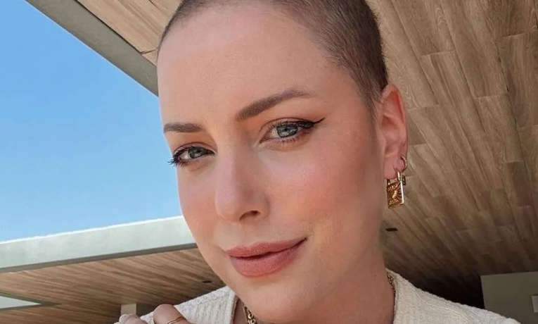 Fabiana Justus foi diagnosticada com leucemia em janeiro de 2024  • Instagram/ Fabiana Justus