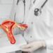SUS amplia atendimento a mulheres com endometriose profunda. União garante aporte de R$ 300 milhões anuais e atualização da Tabela SUS para diagnóstico e tratamento especializado.