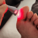 Técnica com luz de LED vem sendo testada em hospitais brasileiros e mostra resultados promissores na recuperação de feridas crônicas, com impacto direto na prevenção de amputações em diabéticos.