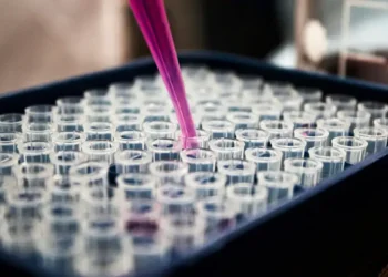 Pesquisadores brasileiros confirmam que exame de sangue com proteína p-tau217 identifica Alzheimer com mais de 90% de precisão. Estudo busca levar o teste ao SUS em até dois anos.
