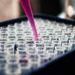 Pesquisadores brasileiros confirmam que exame de sangue com proteína p-tau217 identifica Alzheimer com mais de 90% de precisão. Estudo busca levar o teste ao SUS em até dois anos.