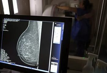 O Ministério da Saúde recebeu o primeiro lote do Trastuzumabe Entansina, medicamento inovador para tratamento de câncer de mama no SUS. Com investimento de R$ 159 milhões, a pasta garantirá o atendimento de 100% da demanda nacional.