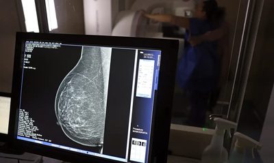 O Ministério da Saúde recebeu o primeiro lote do Trastuzumabe Entansina, medicamento inovador para tratamento de câncer de mama no SUS. Com investimento de R$ 159 milhões, a pasta garantirá o atendimento de 100% da demanda nacional.
