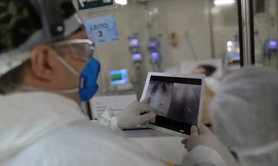 Fiocruz divulga Boletim InfoGripe: Covid-19 foi responsável por 51% das mortes por SRAG em setembro, com aumento de casos graves em Goiás e Distrito Federal.
