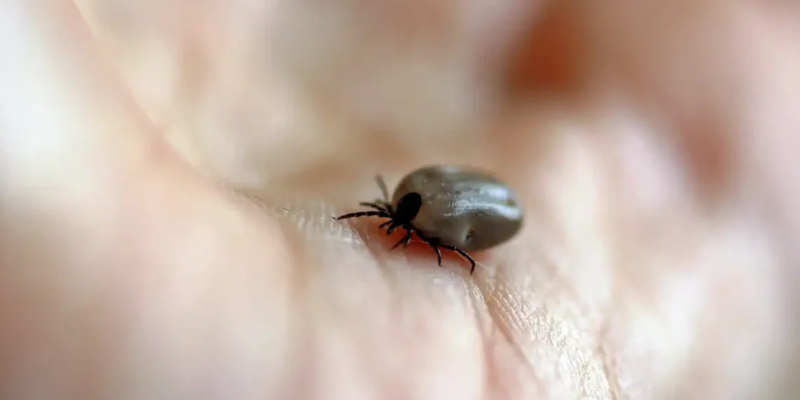 Após três mortes por febre maculosa, Salto (SP) fecha o Parque de Lavras e reforça ações de prevenção. Saiba como se proteger da doença transmitida por carrapatos.