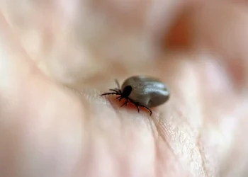 Após três mortes por febre maculosa, Salto (SP) fecha o Parque de Lavras e reforça ações de prevenção. Saiba como se proteger da doença transmitida por carrapatos.