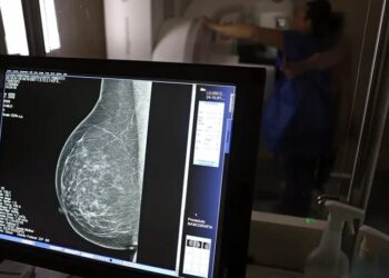 Lei sancionada por Lula garante mamografia no SUS para mulheres a partir dos 40 anos, ampliando o acesso ao diagnóstico precoce do câncer de mama.