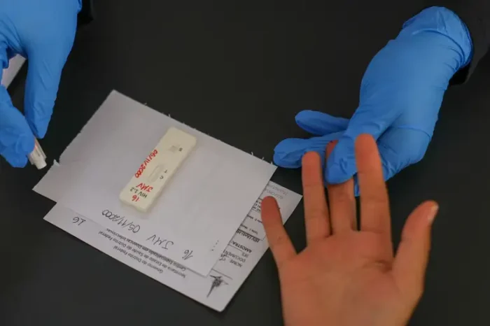 Brasil quer incorporar ao SUS a PrEP injetável semestral com lenacapavir e negocia preço e transferência tecnológica. País registra queda de mortes por aids.