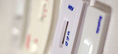 Ministério da Saúde amplia testagem de HIV em comunidades indígenas, com aumento de 47% na cobertura e distribuição de mais de 1 milhão de testes rápidos de ISTs em 2025.