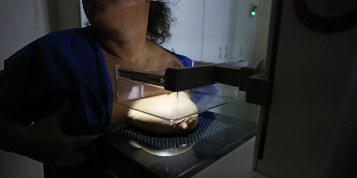 Pesquisa do Vigitel revela aumento na realização de mamografias no Brasil e destaca a ampliação do exame pelo SUS como estratégia para diagnóstico precoce do câncer de mama.