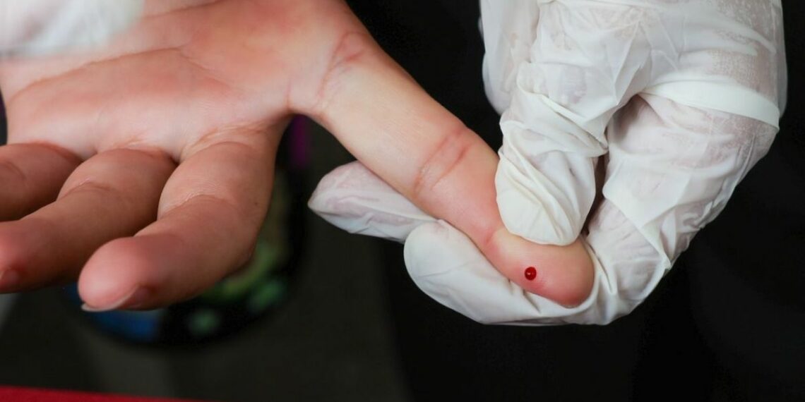 Ministério da Saúde incorpora teste rápido de dengue ao SUS. Exame gratuito detecta a doença precocemente e já está disponível em postos e hospitais.