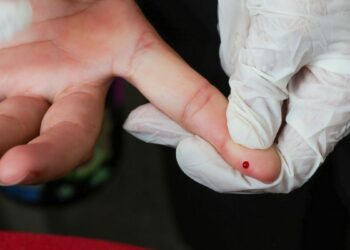Ministério da Saúde incorpora teste rápido de dengue ao SUS. Exame gratuito detecta a doença precocemente e já está disponível em postos e hospitais.