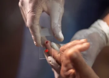 Ministério da Saúde inicia no SUS tratamento contra malária em crianças com tafenoquina pediátrica em dose única. Brasil é o primeiro país a oferecer a terapia.