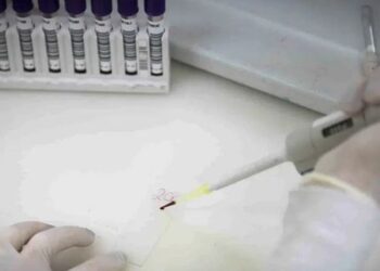 Paciente de 37 anos que retornou da República Democrática do Congo testou positivo para meningite meningocócica. Suspeita de ebola segue sob investigação em São Paulo.