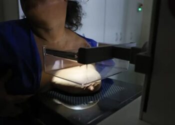 Proposta da ANS prevê cobertura obrigatória da mamografia digital sem limite de idade ou gênero nos planos de saúde.