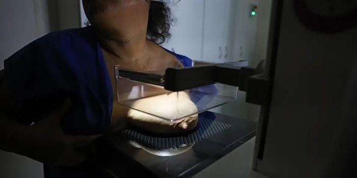 Proposta da ANS prevê cobertura obrigatória da mamografia digital sem limite de idade ou gênero nos planos de saúde.