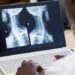Rede HU Brasil ultrapassa 500 mil exames processados por telemedicina e avança na expansão da Telerradiologia para hospitais universitários em todo o país.