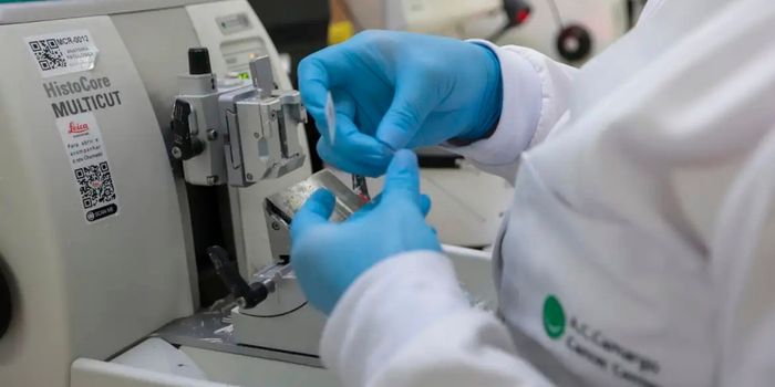 O SUS passará a disponibilizar o tratamento combinado com venetoclax e azacitidina para pacientes com leucemia mieloide aguda recém-diagnosticada. A nova terapia deve chegar à rede pública em até 180 dias.