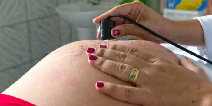 Estudos da Fiocruz revelam que o Bolsa Família contribui para reduzir a mortalidade materna e infantil, além de diminuir casos de tuberculose, HIV, hanseníase e problemas de saúde mental.