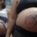 Pesquisa do Unicef mostra que medo da dor, desigualdade e falhas no pré-natal impulsionam o alto número de cesarianas no Brasil.