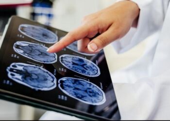 Estudo revela que o álcool pode afetar o Alzheimer de forma diferente conforme a proteína envolvida na doença.