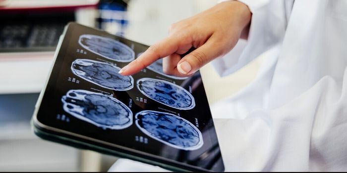 Estudo revela que o álcool pode afetar o Alzheimer de forma diferente conforme a proteína envolvida na doença.