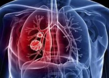 Portaria cria comitê técnico para acompanhar desenvolvimento de sistema portátil de diagnóstico molecular da tuberculose.