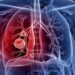 Portaria cria comitê técnico para acompanhar desenvolvimento de sistema portátil de diagnóstico molecular da tuberculose.