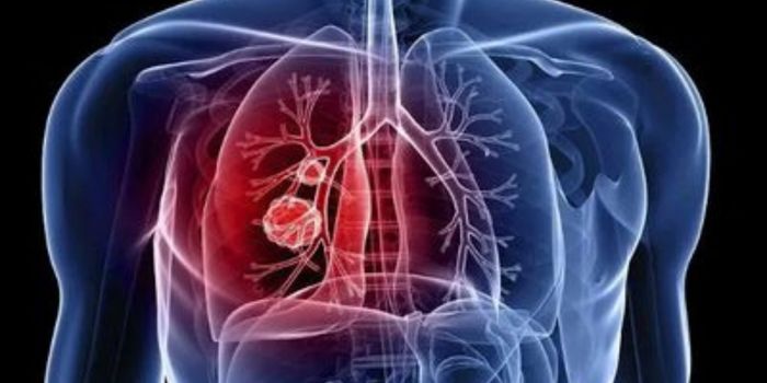 Portaria cria comitê técnico para acompanhar desenvolvimento de sistema portátil de diagnóstico molecular da tuberculose.