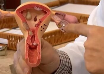CNPq abre edital de R$ 60 milhões para pesquisas sobre endometriose, dor pélvica e saúde menstrual com foco no SUS. Inscrições até 12 de agosto.