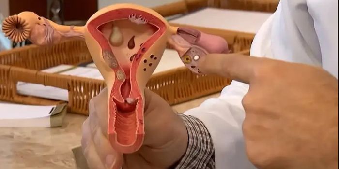 CNPq abre edital de R$ 60 milhões para pesquisas sobre endometriose, dor pélvica e saúde menstrual com foco no SUS. Inscrições até 12 de agosto.