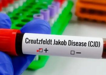 Doença de Creutzfeldt-Jakob é rara e ainda não tem cura. Pesquisadores estudam novos tratamentos e formas mais rápidas de diagnóstico.