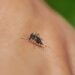 Dengue, zika, chikungunya e Oropouche têm sintomas semelhantes. Especialista explica diferenças, sinais de alerta e formas de prevenção.
