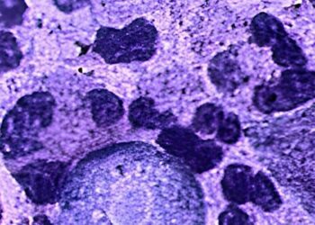 Menina de 8 anos morreu na Louisiana após infecção rara por Naegleria fowleri, ameba encontrada principalmente em águas doces quentes.
