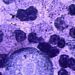 Menina de 8 anos morreu na Louisiana após infecção rara por Naegleria fowleri, ameba encontrada principalmente em águas doces quentes.