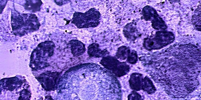 Menina de 8 anos morreu na Louisiana após infecção rara por Naegleria fowleri, ameba encontrada principalmente em águas doces quentes.