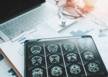 Estudo da Universidade Estadual da Pensilvânia aponta que contrações abdominais podem provocar mudanças rápidas no fluxo sanguíneo cerebral.