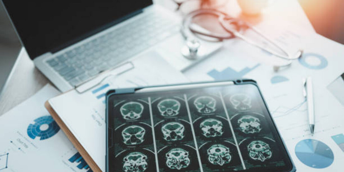Estudo da Universidade Estadual da Pensilvânia aponta que contrações abdominais podem provocar mudanças rápidas no fluxo sanguíneo cerebral.
