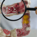 Estudo apresentado em congresso aponta aumento das doenças inflamatórias intestinais no Brasil e prevê crescimento dos casos até 2035.