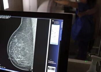 ANS amplia a cobertura da mamografia digital pelos planos de saúde. A partir de 1º de outubro, exame será obrigatório para todas as pessoas com indicação médica